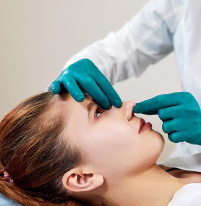 Rinoplastia
